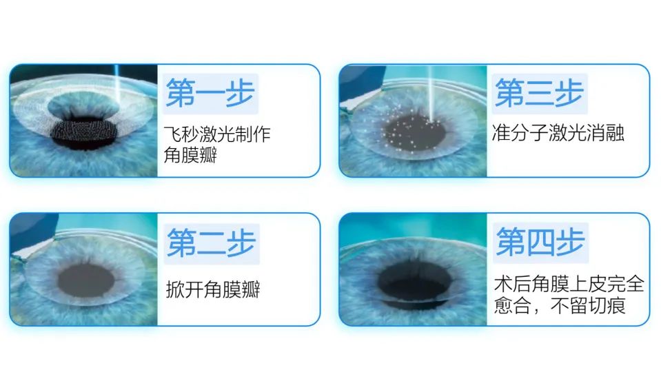 许昌爱尔眼科