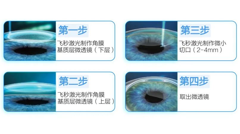 许昌爱尔眼科