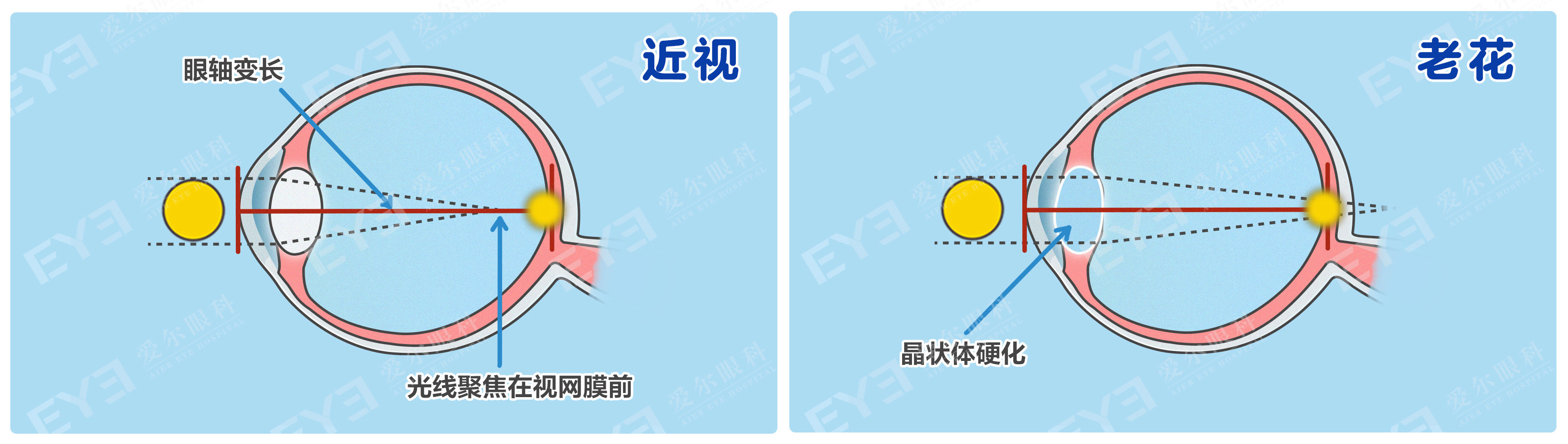 许昌爱尔眼科