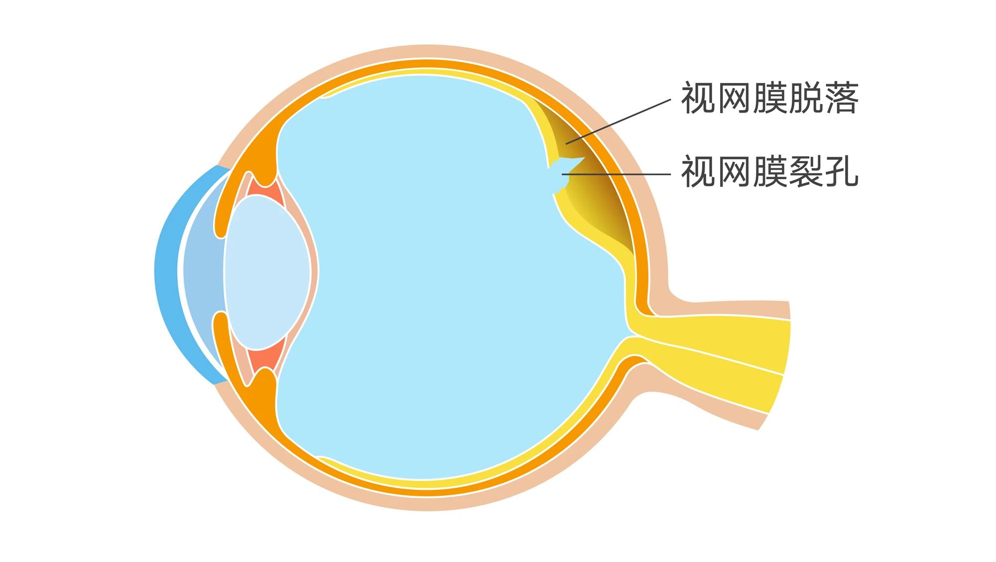 许昌爱尔眼科