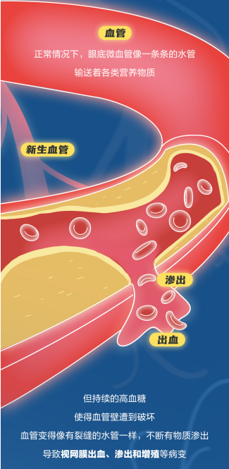 许昌爱尔眼科