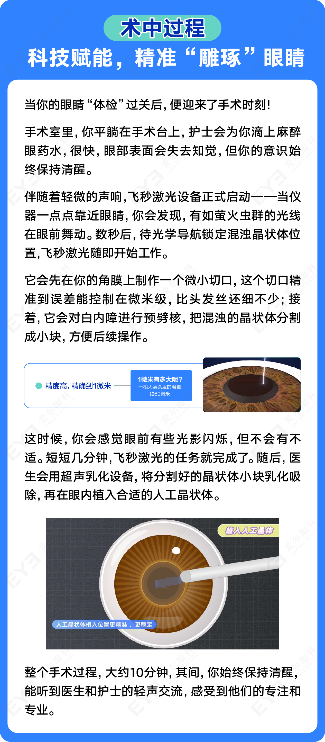 许昌爱尔眼科
