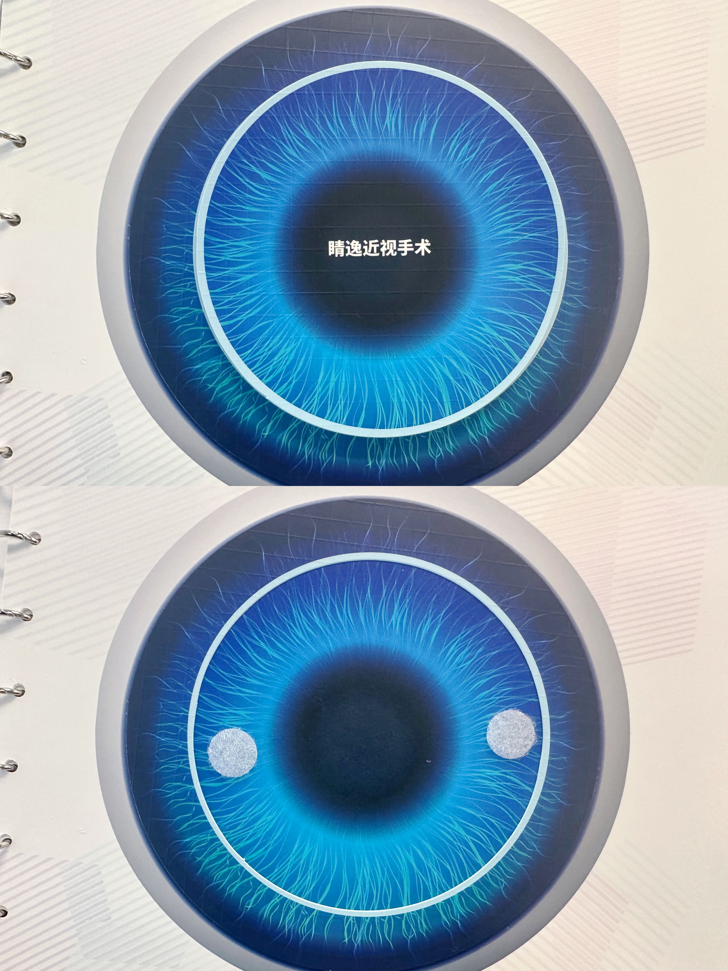 许昌爱尔眼科