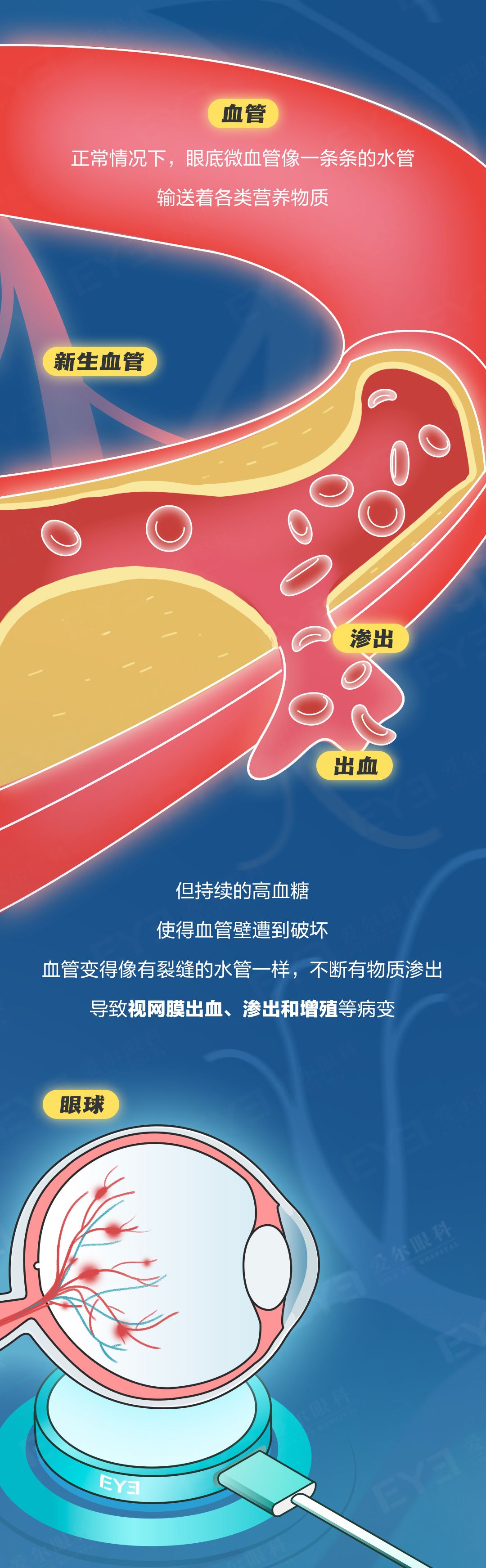 许昌爱尔眼科
