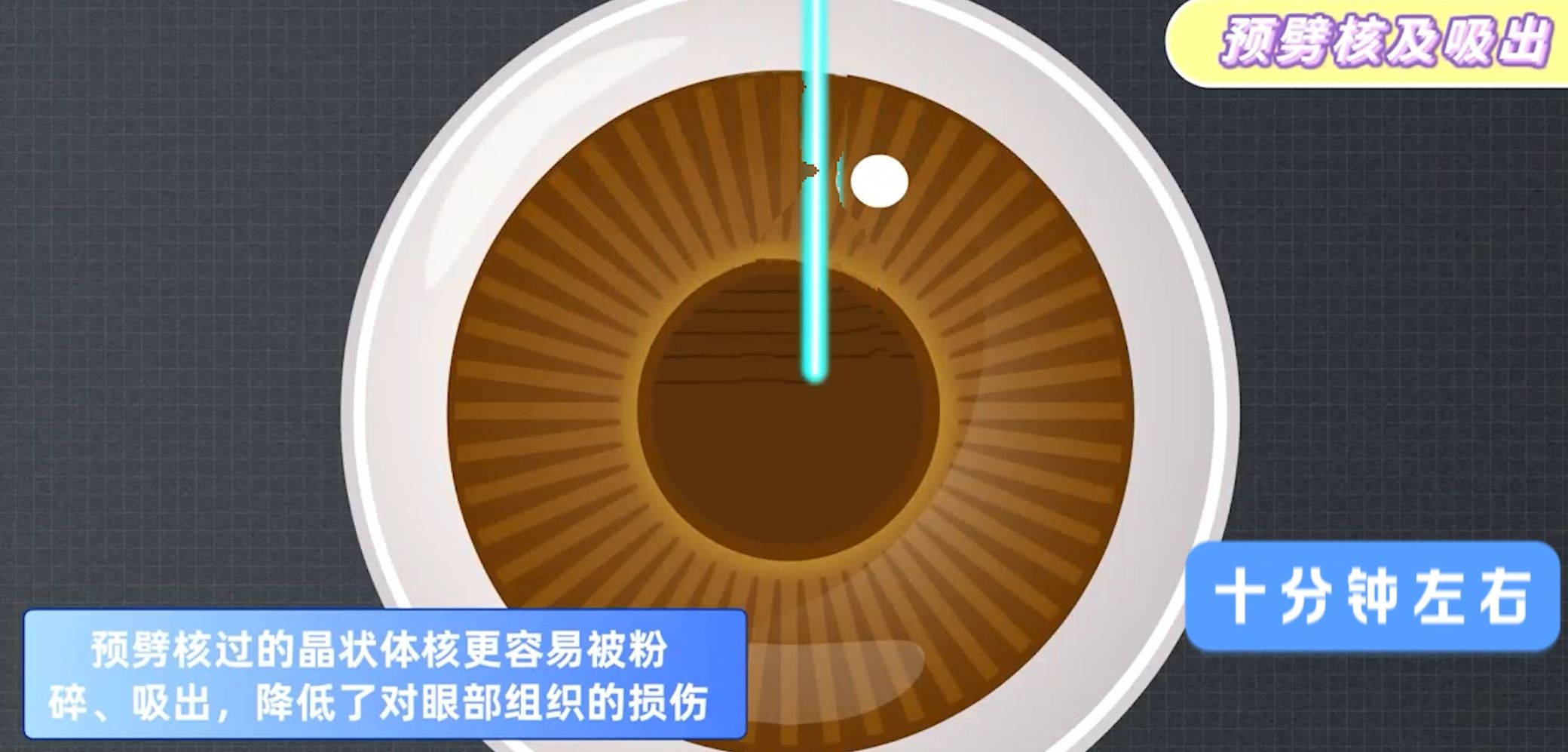 许昌爱尔眼科