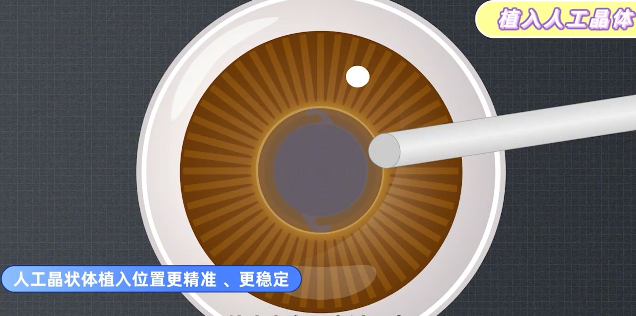 许昌爱尔眼科